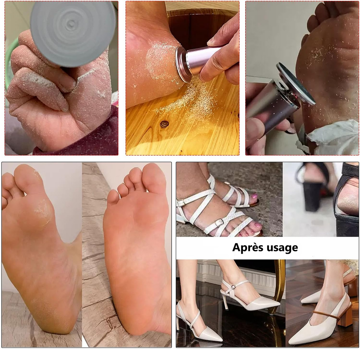 Ponceuse électrique pour pieds – pédicure & anti-callosités.